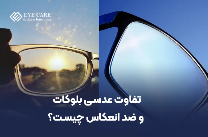تفاوت عدسی بلوکات و ضد انعکاس چیست؟
